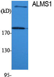Fig1:; Western Blot analysis of various cells using ALMS1 Polyclonal Antibody