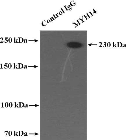IP Result of anti-MYH14 (IP:Catalog No:112931, 4ug; Detection:Catalog No:112931 1:2000) with mouse kidney tissue lysate 4800ug.