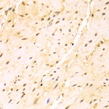 Immunohistochemistry - SRSF1 Polyclonal Antibody 