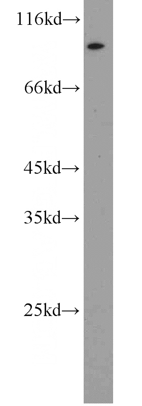 NIH/3T3 cells were subjected to SDS PAGE followed by western blot with Catalog No:114609(RBM28 antibody) at dilution of 1:1500