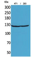 Fig1:; Western Blot analysis of 4T1, 293 cells using Integrin αD Polyclonal Antibody.. Secondary antibody（catalog#: HA1001) was diluted at 1:20000