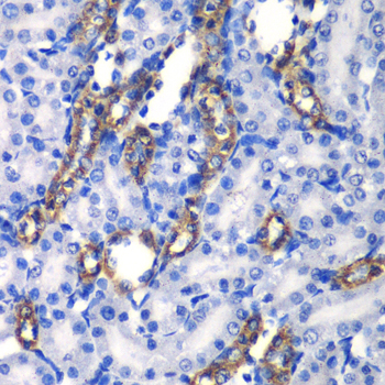 Immunohistochemistry - MATK Polyclonal Antibody 