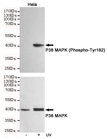 Western blot analysis of extracts from Hela cells, untreated or treated with UV, using P38 MAPK (Phospho-Tyr182) Rabbit pAb (167108,1:500 diluted,upper) or p38 MAPK Rabbit pAb (310008,1:500 diluted,lower).