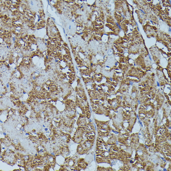 Immunohistochemistry - FKBP1B Polyclonal Antibody 