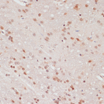 Immunohistochemistry - Phospho-PEA15-S104 pAb 