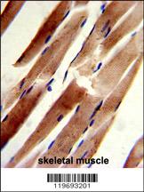 Formalin-fixed and paraffin-embedded human skeletal muscle reacted with ACTR2 Antibody (C-term), which was peroxidase-conjugated to the secondary antibody, followed by DAB staining. This data demonstrates the use of this antibody for immunohistochemistry;