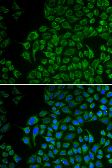Immunofluorescence - TYR Polyclonal Antibody 