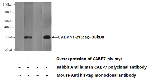 Transfected HEK-293 cells were subjected to SDS PAGE followed by western blot with Catalog No:108755(CABP7 Antibody) at dilution of 1:1000
