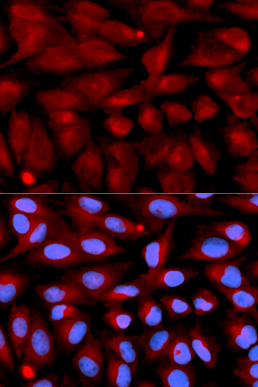 Immunofluorescence - CD70 Polyclonal Antibody 