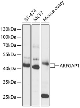 Western blot - ARFGAP1 Polyclonal Antibody 