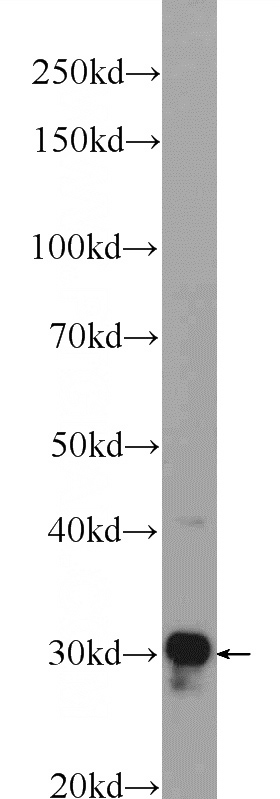 mouse liver tissue were subjected to SDS PAGE followed by western blot with Catalog No:115970(CCDC44 Antibody) at dilution of 1:600