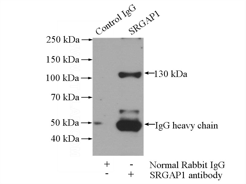 IP Result of anti-SRGAP1 (IP:Catalog No:115585, 4ug; Detection:Catalog No:115585 1:500) with mouse kidney tissue lysate 4000ug.