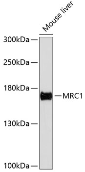 Western blot - MRC1 Polyclonal Antibody 