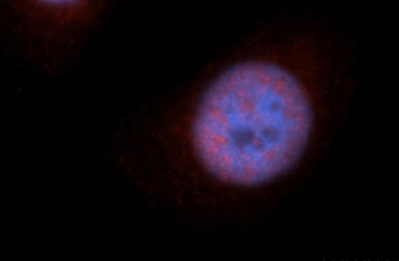 Immunofluorescent analysis of Hela cells, using RBM17 antibody Catalog No:114603 at 1:50 dilution and Rhodamine-labeled goat anti-rabbit IgG (red). Blue pseudocolor = DAPI (fluorescent DNA dye).