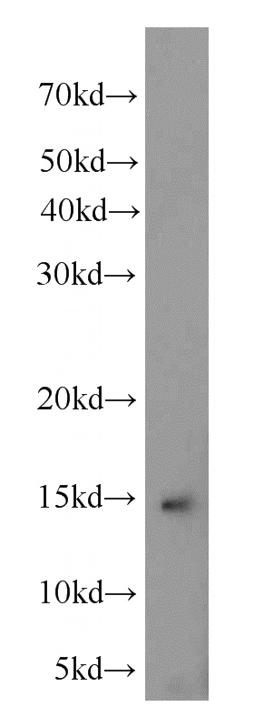 human heart tissue were subjected to SDS PAGE followed by western blot with Catalog No:113062(NDUFA6 antibody) at dilution of 1:800