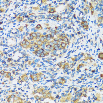 Immunohistochemistry - APOBEC3F Polyclonal Antibody 