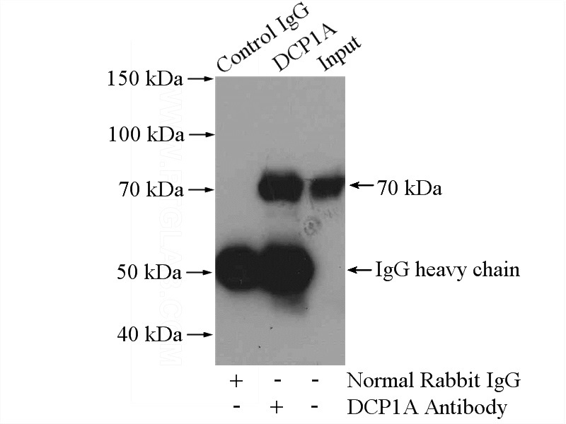 IP Result of anti-DCP1A (IP:Catalog No:109754, 4ug; Detection:Catalog No:109754 1:3000) with mouse brain tissue lysate 3200ug.