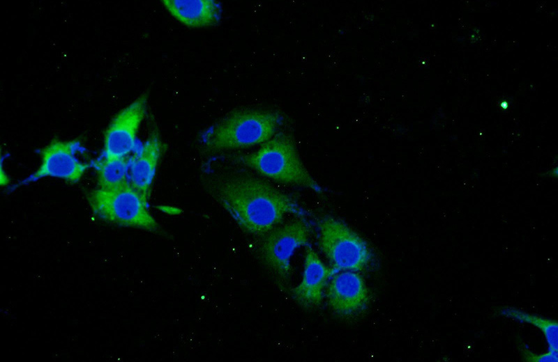 Immunofluorescent analysis of SH-SY5Y cells using Catalog No:115726(STMN2 Antibody) at dilution of 1:25 and Alexa Fluor 488-congugated AffiniPure Goat Anti-Rabbit IgG(H+L)
