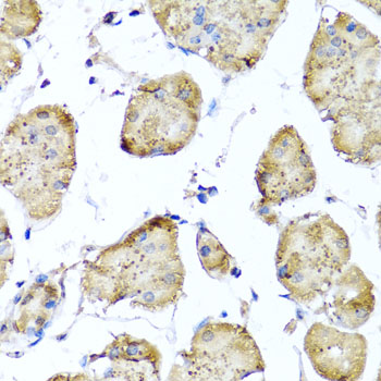 Immunohistochemistry - STK3 Polyclonal Antibody 
