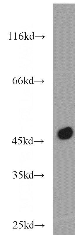 mouse pancreas tissue were subjected to SDS PAGE followed by western blot with Catalog No:108847(CPA1 antibody) at dilution of 1:3000