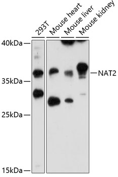 Western blot - NAT2 Polyclonal Antibody 