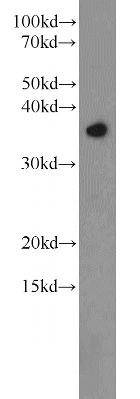 HepG2 cells were subjected to SDS PAGE followed by western blot with Catalog No:115075(SEC13 antibody) at dilution of 1:1000