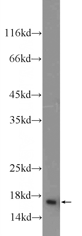 mouse liver tissue were subjected to SDS PAGE followed by western blot with Catalog No:111360(HIST1H2AC Antibody) at dilution of 1:300