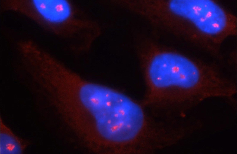 Immunofluorescent analysis of HepG2 cells using Catalog No:114845(RPS6KA3 Antibody) at dilution of 1:25 and Rhodamine-Goat anti-Rabbit IgG