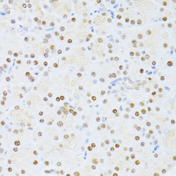Immunohistochemistry - ETV1 Polyclonal Antibody 