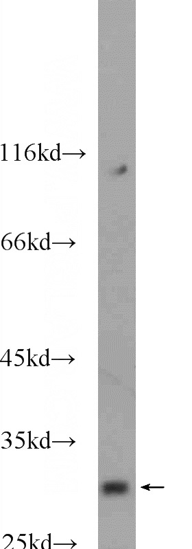mouse brain tissue were subjected to SDS PAGE followed by western blot with Catalog No:115278(SHOX Antibody) at dilution of 1:1000