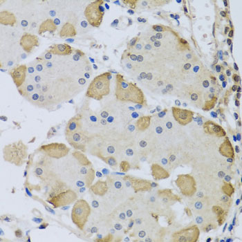 Immunohistochemistry - ANAPC10 Polyclonal Antibody 