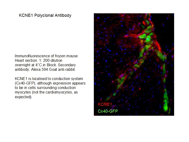 IF result of anti-KCNE1(Catalog No:111928) in frozen mouse heart section by Dr Nicola Smart.