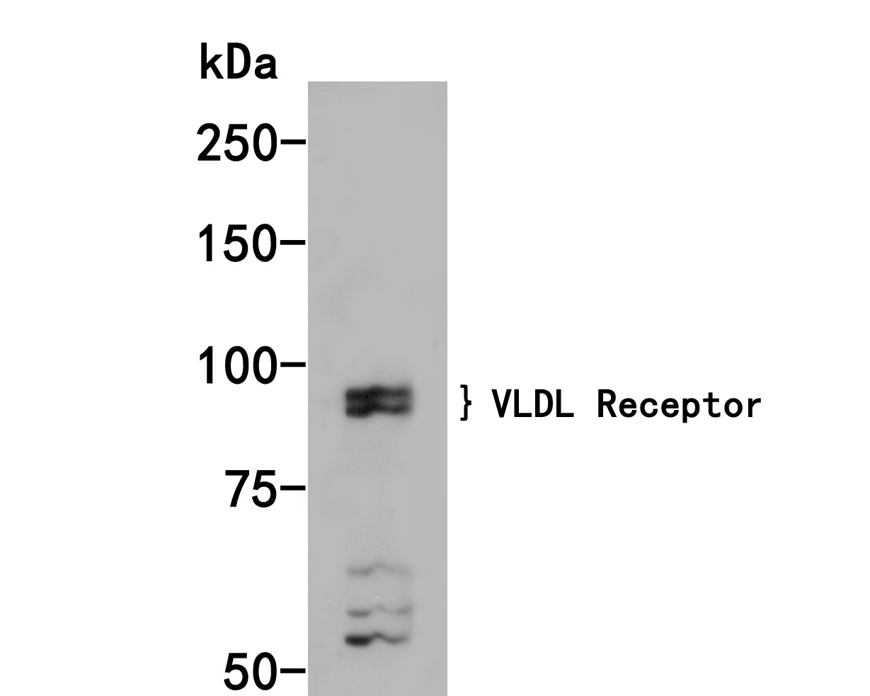 Fig1:; Western blot analysis of VLDL Receptor on 293 cell lysates. Proteins were transferred to a PVDF membrane and blocked with 5% BSA in PBS for 1 hour at room temperature. The primary antibody ( 1/1,000) was used in 5% BSA at room temperature for 2 hours. Goat Anti-Rabbit IgG - HRP Secondary Antibody (HA1001) at 1:200,000 dilution was used for 1 hour at room temperature.