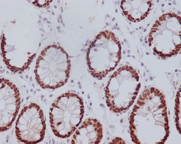 Immunohistochemical analysis of paraffin-embedded human colon, using CDX2 Antibody.