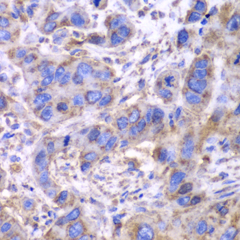 Immunohistochemistry - SDHA Polyclonal Antibody 