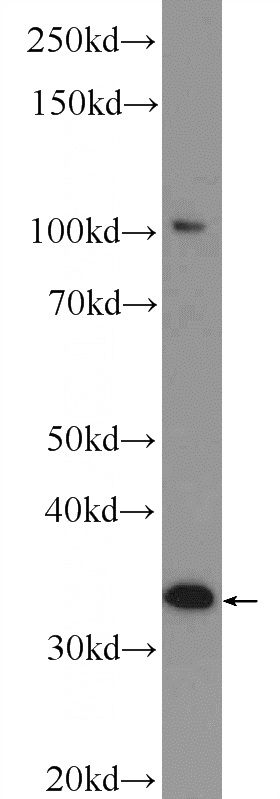 HeLa cells were subjected to SDS PAGE followed by western blot with Catalog No:112692(MMADHC Antibody) at dilution of 1:600