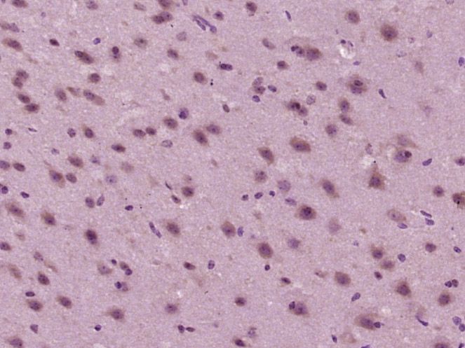 Fig2: Paraformaldehyde-fixed, paraffin embedded (mouse brain tissue); Antigen retrieval by boiling in sodium citrate buffer (pH6.0) for 15min; Block endogenous peroxidase by 3% hydrogen peroxide for 20 minutes; Blocking buffer (normal goat serum) at 37℃ for 30min; Antibody incubation with (GPR125) Polyclonal Antibody, Unconjugated at 1:400 overnight at 4℃, followed by operating according to SP Kit(Rabbit) (sp-0023) instructionsand DAB staining.