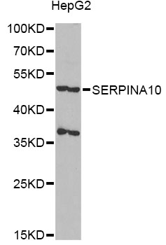 Western blot - SERPINA10 Polyclonal Antibody 