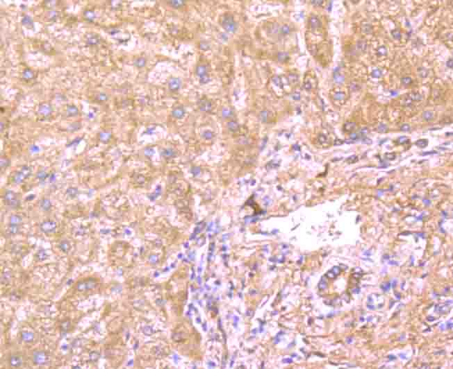 Fig5: Immunohistochemical analysis of paraffin-embedded human liver tissue using anti-CD130 antibody. Counter stained with hematoxylin.