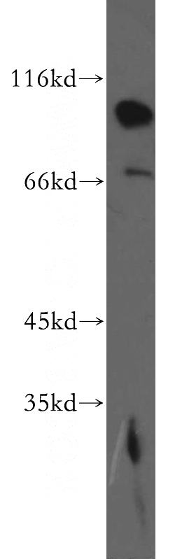 BxPC-3 cells were subjected to SDS PAGE followed by western blot with Catalog No:110393(EPS15L1 antibody) at dilution of 1:500