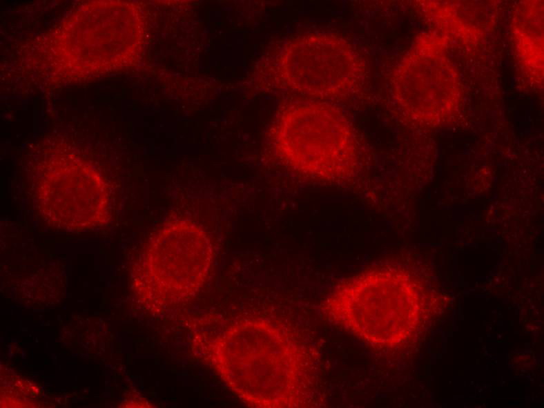 Immunofluorescence staining of methanol-fixed MCF cells using eIF4E (Phospho-Ser209) Antibody .
