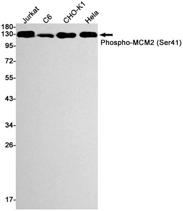Western blot detection of Phospho-MCM2 (Ser41) in Jurkat,C6,CHO-K1,Hela cell lysates using Phospho-MCM2 (Ser41) Rabbit mAb(1:1000 diluted).Predicted band size:102kDa.Observed band size:125kDa.