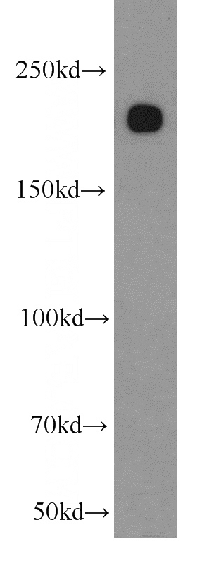 mouse kidney tissue were subjected to SDS PAGE followed by western blot with Catalog No:112937(MYH9 antibody) at dilution of 1:1000