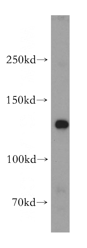 mouse colon tissue were subjected to SDS PAGE followed by western blot with Catalog No:113300(NOMO1 antibody) at dilution of 1:500