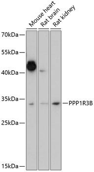 Western blot - PPP1R3B Polyclonal Antibody 