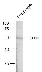 Fig1: Sample:; Lymph node (Mouse) Lysate at 40 ug; Primary: Anti-CD80 at 1/500 dilution; Secondary: IRDye800CW Goat Anti-Rabbit IgG at 1/20000 dilution; Predicted band size: 32 kD; Observed band size: 60 kD