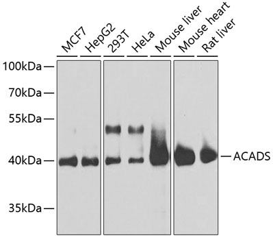 Western blot - ACADS Polyclonal Antibody 