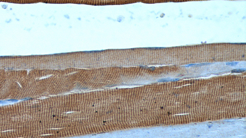 Immunohistochemistry of paraffin-embedded human skeletal muscle tissue slide using Catalog No:108347(ATP2A1 Antibody) at dilution of 1:200 (under 40x lens).
