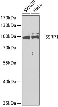 Western blot - SSRP1 Polyclonal Antibody 