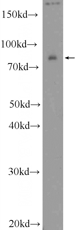 mouse brain tissue were subjected to SDS PAGE followed by western blot with Catalog No:114409(RAB11FIP3 Antibody) at dilution of 1:600